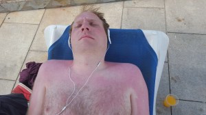 Dette er ca 1 time i solen, første dagen vi ankom. Resten av uken lå jeg under en parasoll, og badet i faktor 30.